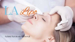 Woman receiving Actinic Keratosis Removal Treatment Barnet