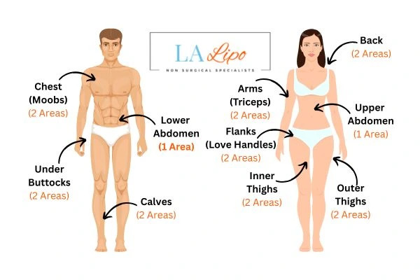 LA LIPO Cryolipolysis Areas Barnet