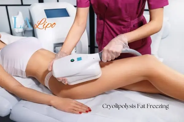 Woman receiving coolsculpting Barnet treatment on her thighs