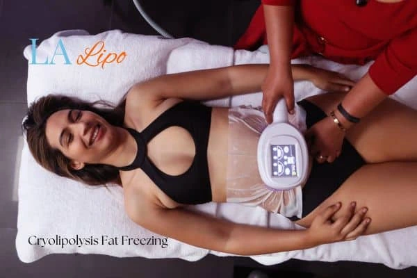 woman getting cryolipolysis Barnet