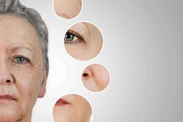 HIFU Facelift Barnet from LA LIPO