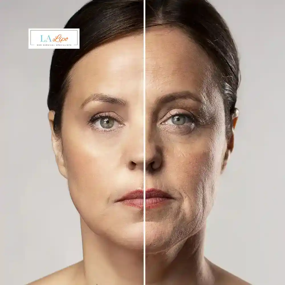 How Can You Tell If Non-Surgical Skin Tightening Is Right for You Barnet?