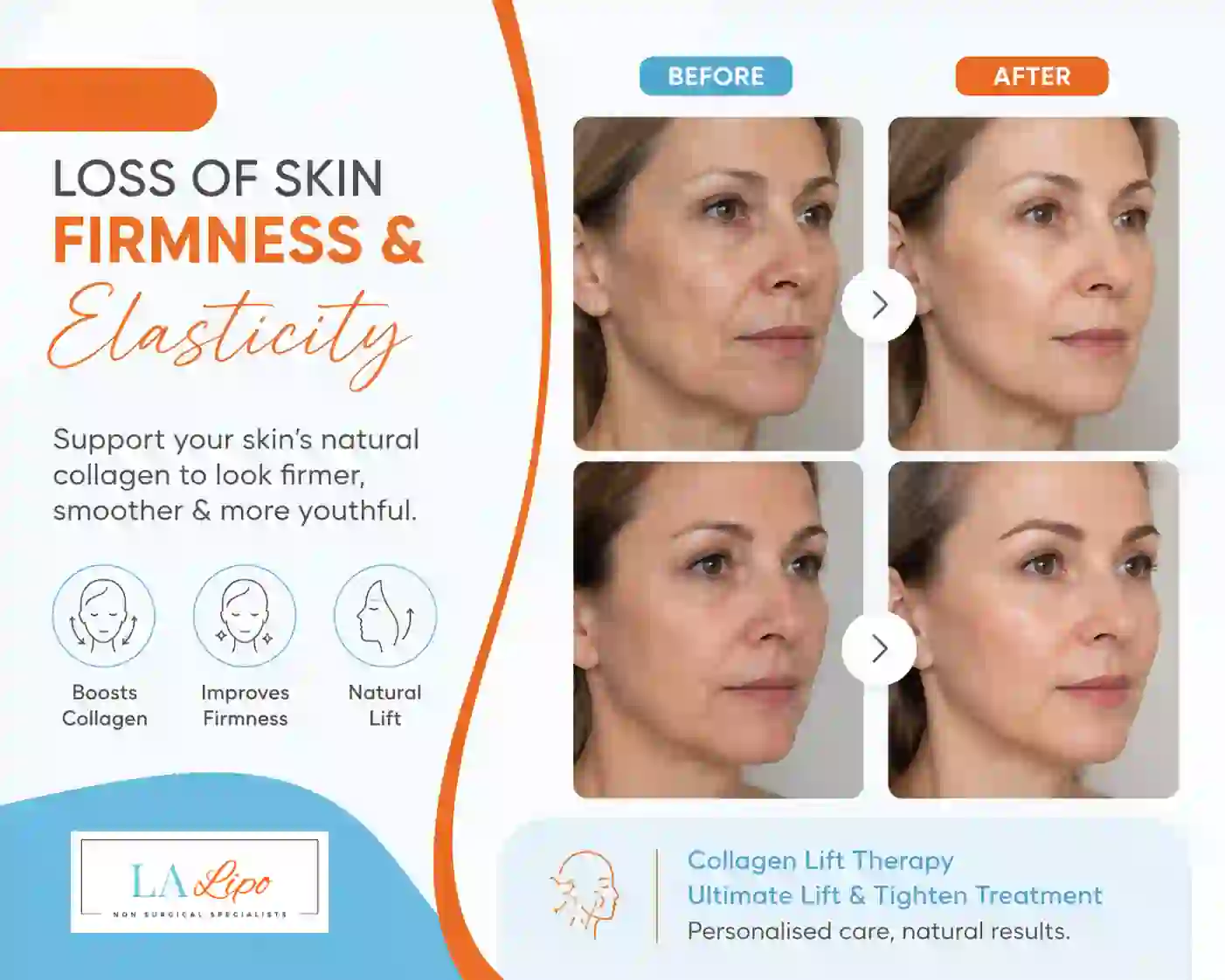 Sign #7: Loss of Skin Firmness and Elasticity Barnet