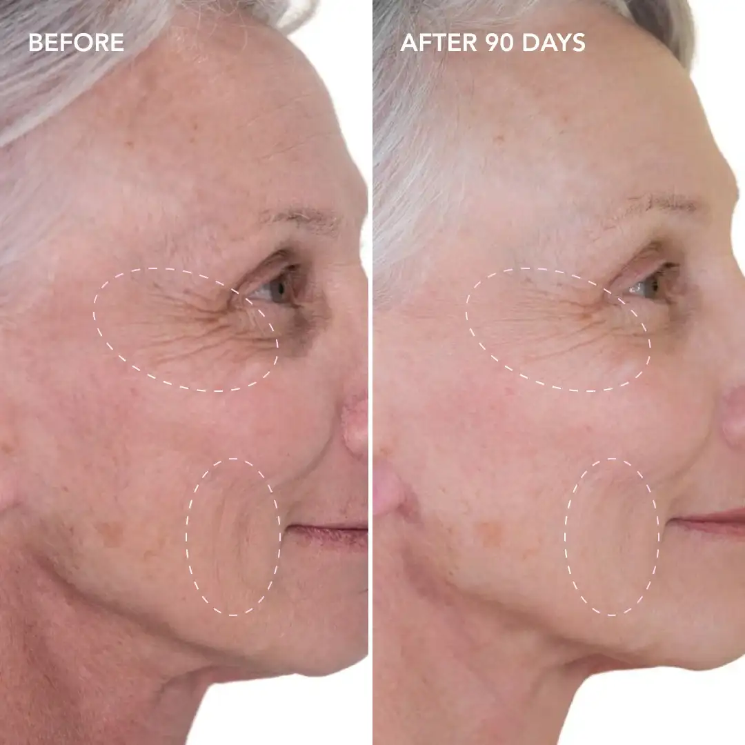 When will you see results Barnet